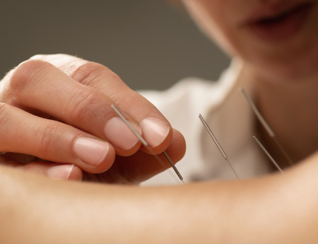 Acupunturist treating patient chronic back pain